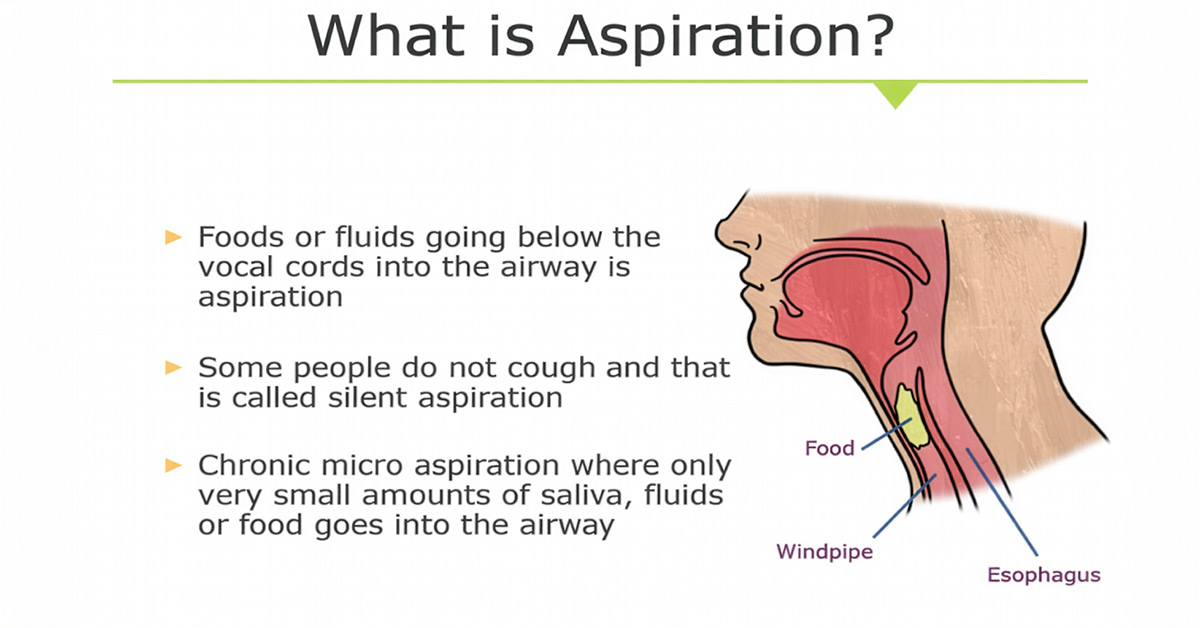 What-Is-Aspiration